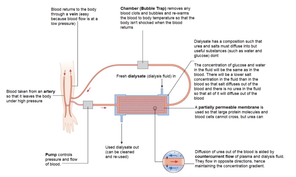 Dialysis